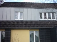 Gaubeneindeckungen mit PREFA-Stehfalz Vorbewittert